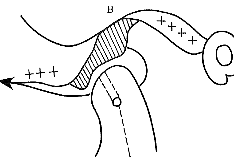 28ff71a89420ca7ad7bc92f14d567a4b74ae8436aaf2af478df09c9306b5f596.png