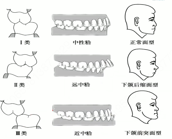 a1b930b32fdd6a452974214be1ff1f739f86b644ad50b9feba3cb6ff41b4736d.png