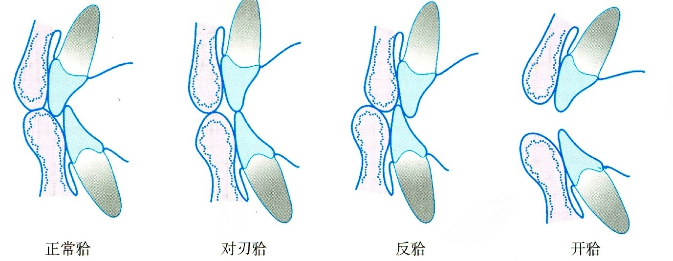 b5fd2c23025955d7332b5410e4e26f00d5693fa3bf5aacaa0291bfc4d1628dca.png