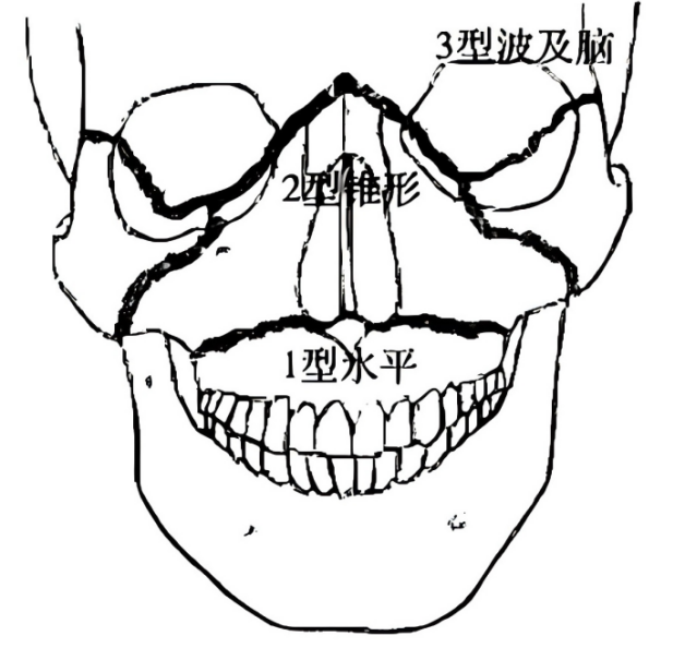 bbdddff369d04c5adf331579ab029c6ac5c78a4f0535ddbe42766574844f9e69.png