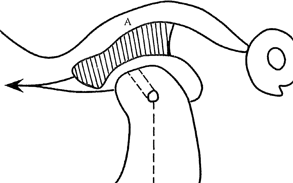 bc64fa8c7f618d98b03eac096acbb4be0d6fda790053f8adb91b667dc7012583.png