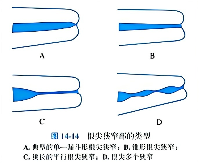 dd1c95e5b93b69bc250331a6c3cfefe10e51b0116b260cd8532919982cfaf3cb.png