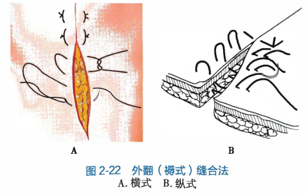 Pasted image 20260902091156.png