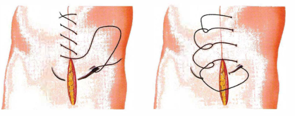 Pasted image 20260902091137.png